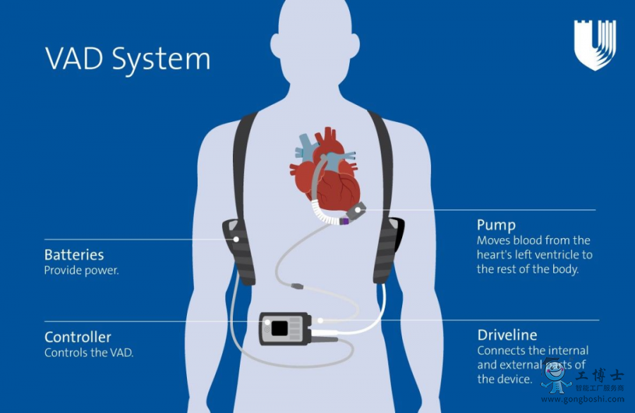 磁懸浮人工心臟